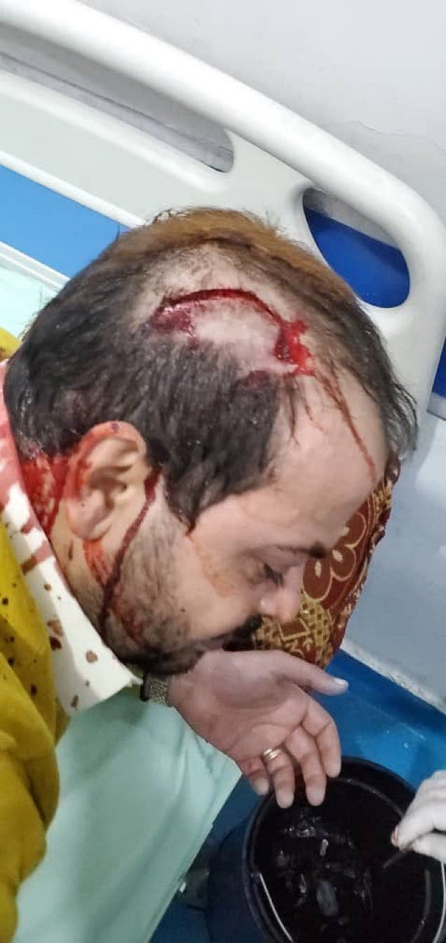 الإصابة التي تعرض لها أحد أبناء أحمد الكبوس